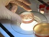 2026年做试管婴儿要多少钱？国内试管婴儿的费用？