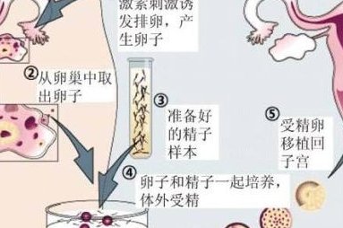 2026在河南做一次试管婴儿费用要多少？