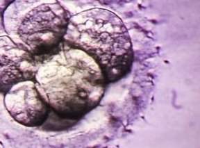 在荆州做一次试管婴儿需要多少钱？哪些人适合做试管婴儿？